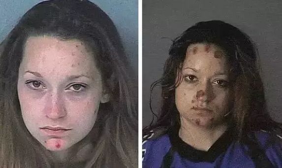 触目惊心吸毒前后真实的对比,吸毒前后可怕容貌变化