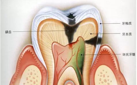 口腔常见疾病种类“大赏”，总有你经历过的