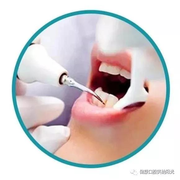 洗牙到底好不好,喷砂洗牙到底好不好