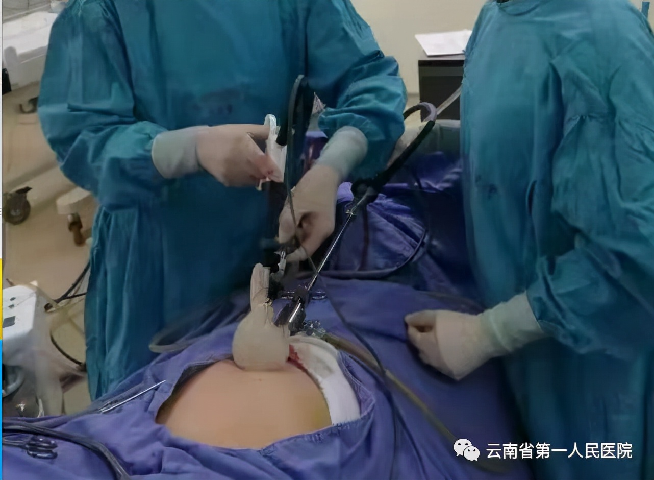 只需住院1天只开一个小孔成功开展单孔腹腔镜下子宫肌瘤根治术