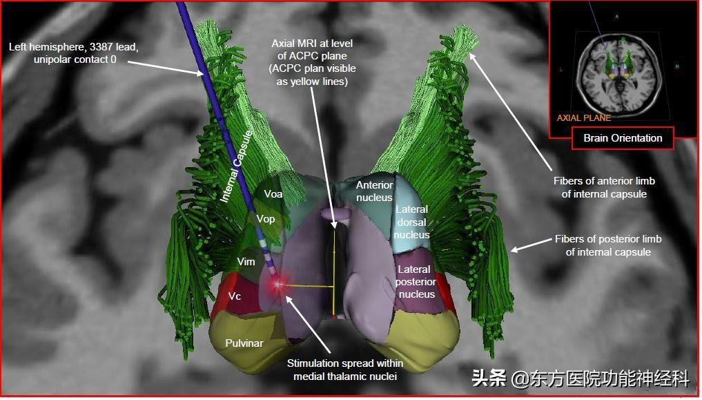 精神疾病常年复发久治不愈的难题该如何破解?