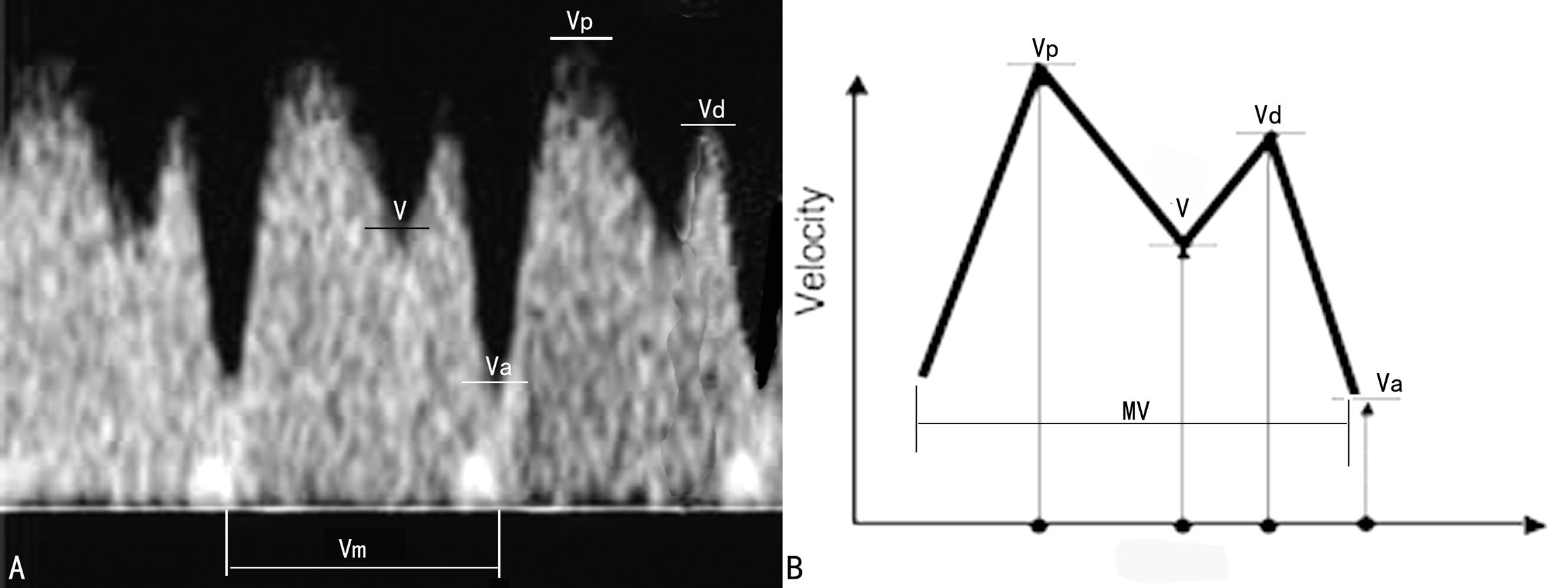 胎儿系统超声检查彩色多普勒,胎儿多普勒超声的一些数据