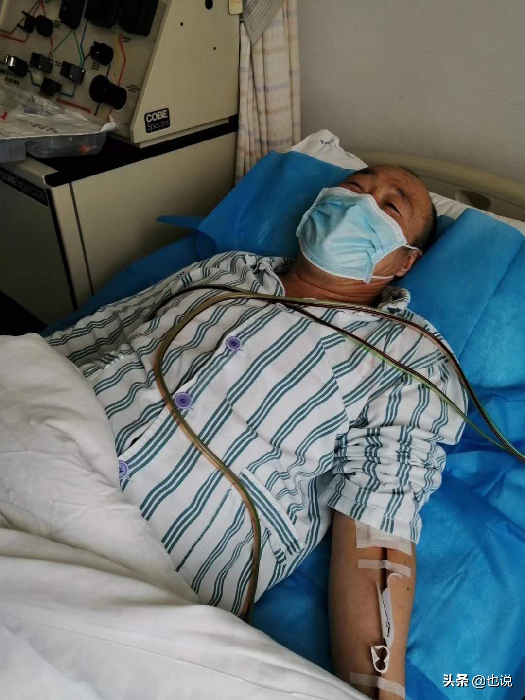 女儿骨髓移植后遗症,骨髓移植后血小板一直个位数