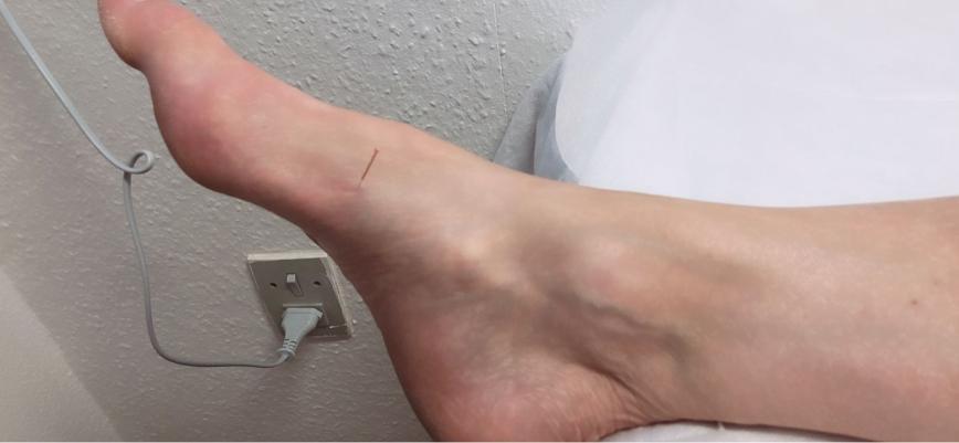 大腿内侧痛是肝气郁结吗,大腿内侧疼痛和肠道有关系吗