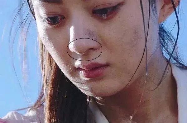 黑头多怎么办如何去除黑头,黑头贴去除顽固黑头