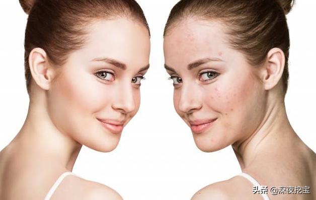 皮肤暗沉的救星,皮肤发黄发暗的救星