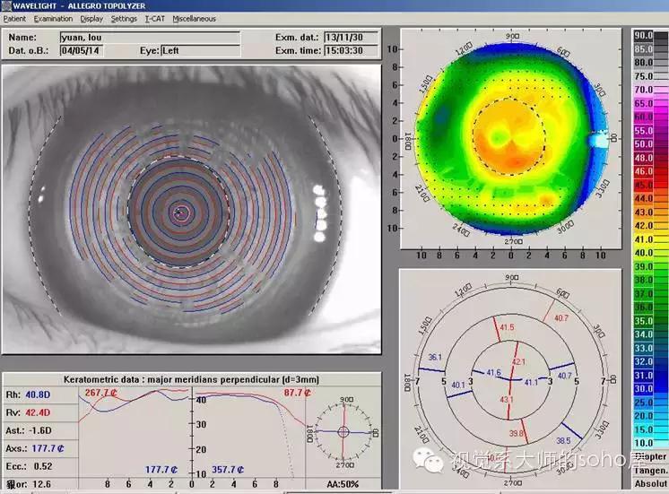 如何选择角膜塑形镜的品牌,怎么选角膜塑形镜的参数