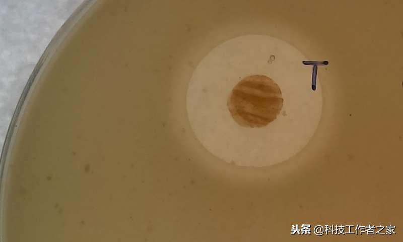 抗细菌最好的克星,超级细菌的克星有哪些