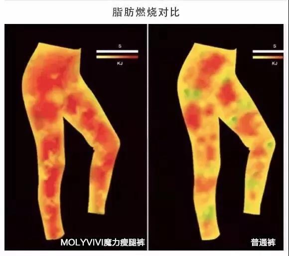 女子花8万做抽脂减肥,女子花68万做十次抽脂术