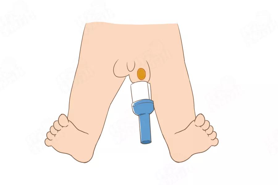 错不起!娃包皮长、丁丁小...7大*处私**异常,立马送医