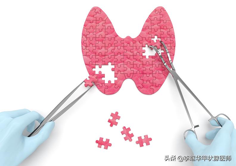 甲状腺结节多发伴钙化建议随访,甲状腺结节4b可以随访观察吗