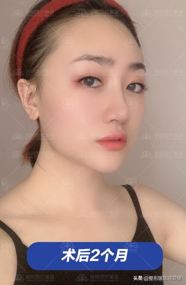 塌鼻妹逆袭,塌鼻妹