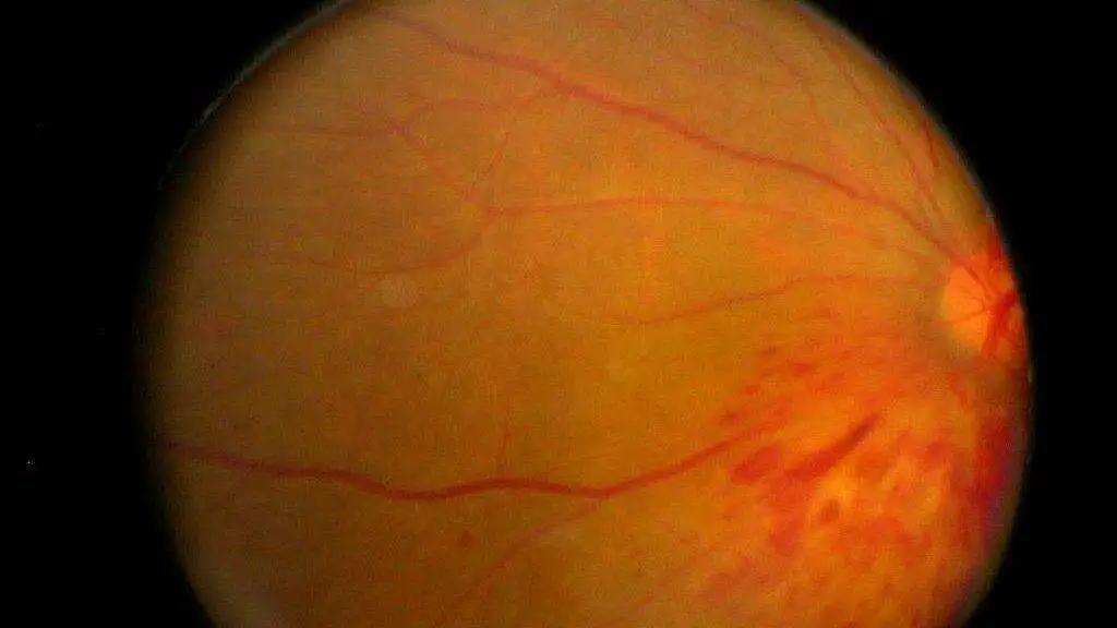 日食裸眼观看图片,裸眼看太阳会怎么样