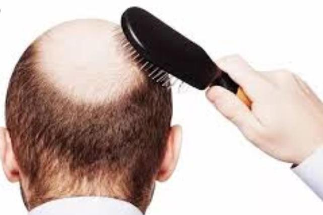 世界首家头发银行开业:冷冻头发样本,若秃顶可把细胞注射回头皮