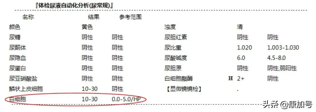 读懂体检单丨尿常规检查，能看出来肾好不好？一文教你看懂