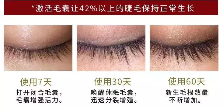 睫毛增长液真的有用吗测评,吉克隽逸睫毛增长液同款