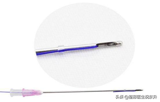 30岁做线雕提升还是筋膜悬吊,最新抗衰线雕