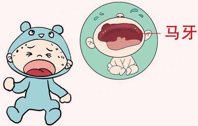 宝宝舌头上有白泡可以用针挑吗,婴儿嘴里的小白点可以用针戳掉吗