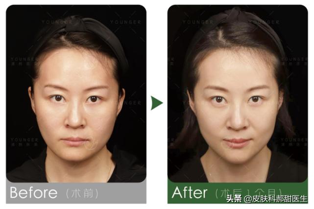 漾格医疗美容怎么样,漾格医美怎么样