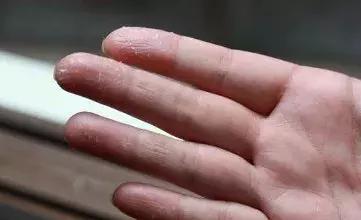 冬天这样护肤,睡觉都是“滑”进去的