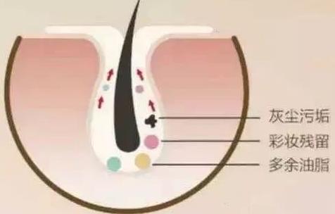 石墨烯面膜是智商税吗,石墨烯面膜到底真的假的