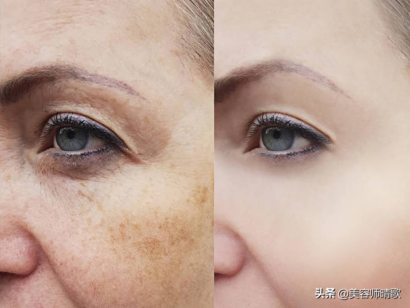 小银瓶淡斑精华推荐,美白淡斑小白瓶精华