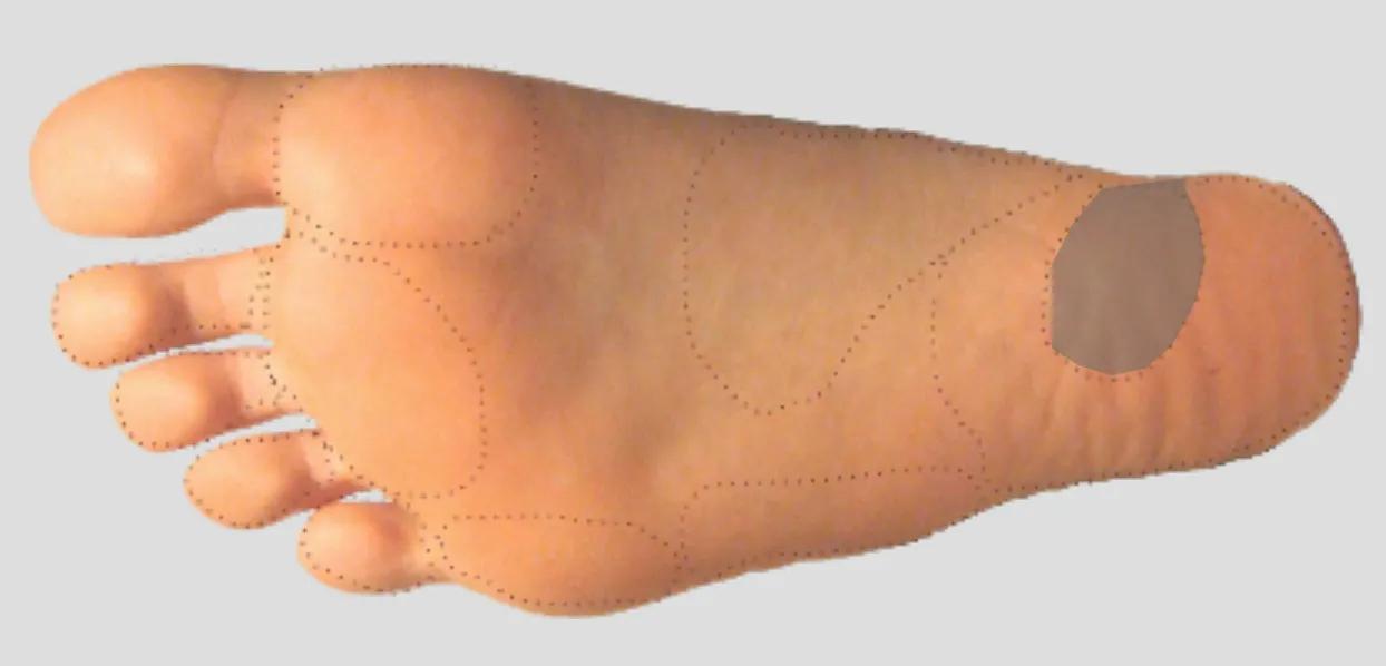 足踝外侧足底疼痛,内踝下方靠近足底的哪个位置痛