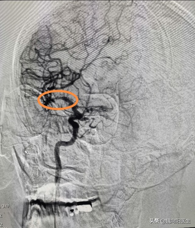 做了胃镜为什么不能吃饭,做胃镜一下子就没有意识了
