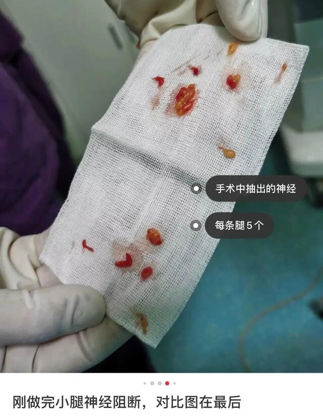 私密整容紧缩手术在中国合法吗,整容医院做私密收紧术要住院吗