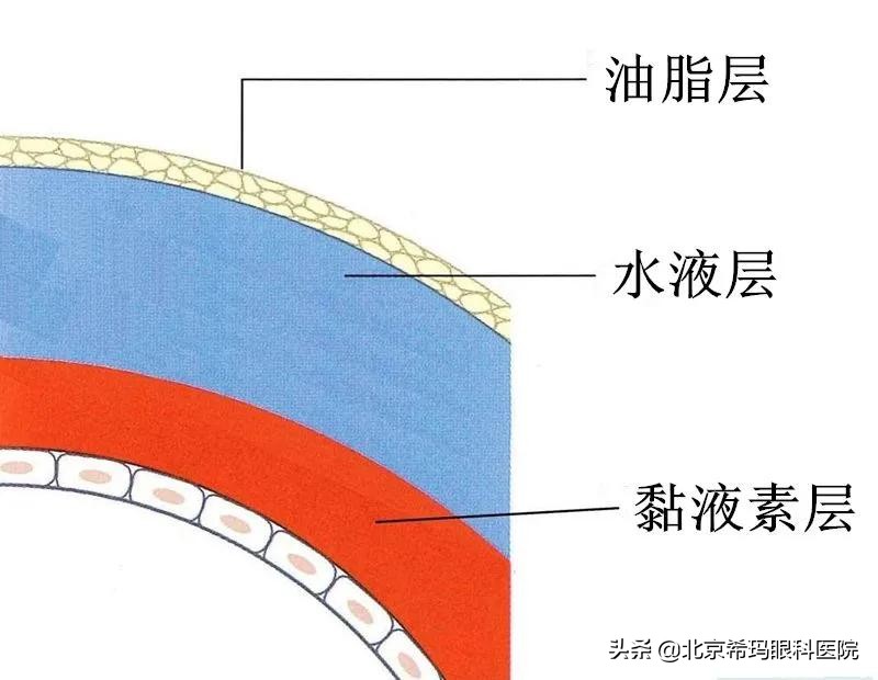 我得了干眼症可以治吗,干眼症缺油怎么办