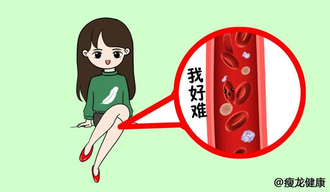 静脉曲张的危害什么是静脉曲张,预防静脉曲张穿多久静脉曲张袜