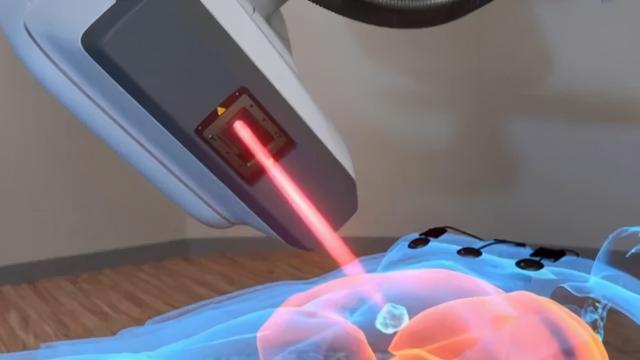 直肠癌放疗中的注意事项