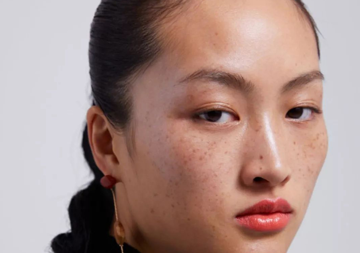 脸上有斑和手上有斑怎么回事,怎样知道自己脸上的斑是哪种斑