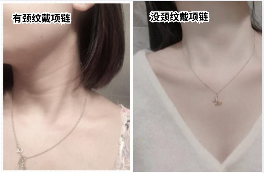 女人30岁脸上皱纹怎么除皱最安全,30岁的女人有皱纹有细纹怎么抗皱