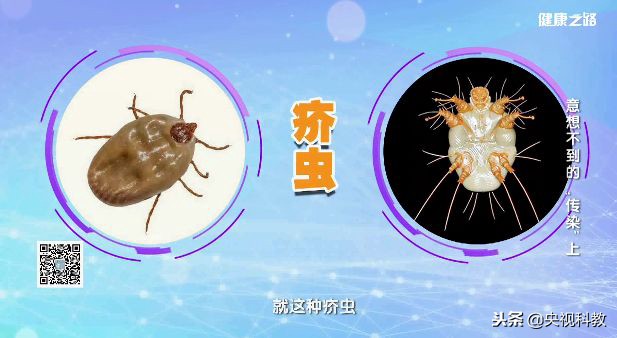 拯救酒糟鼻、脚气、灰指甲、疥疮，最简单便宜的方法！