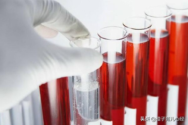 想知道自己是否怀孕应做哪种检查,想知道是否怀孕的方法