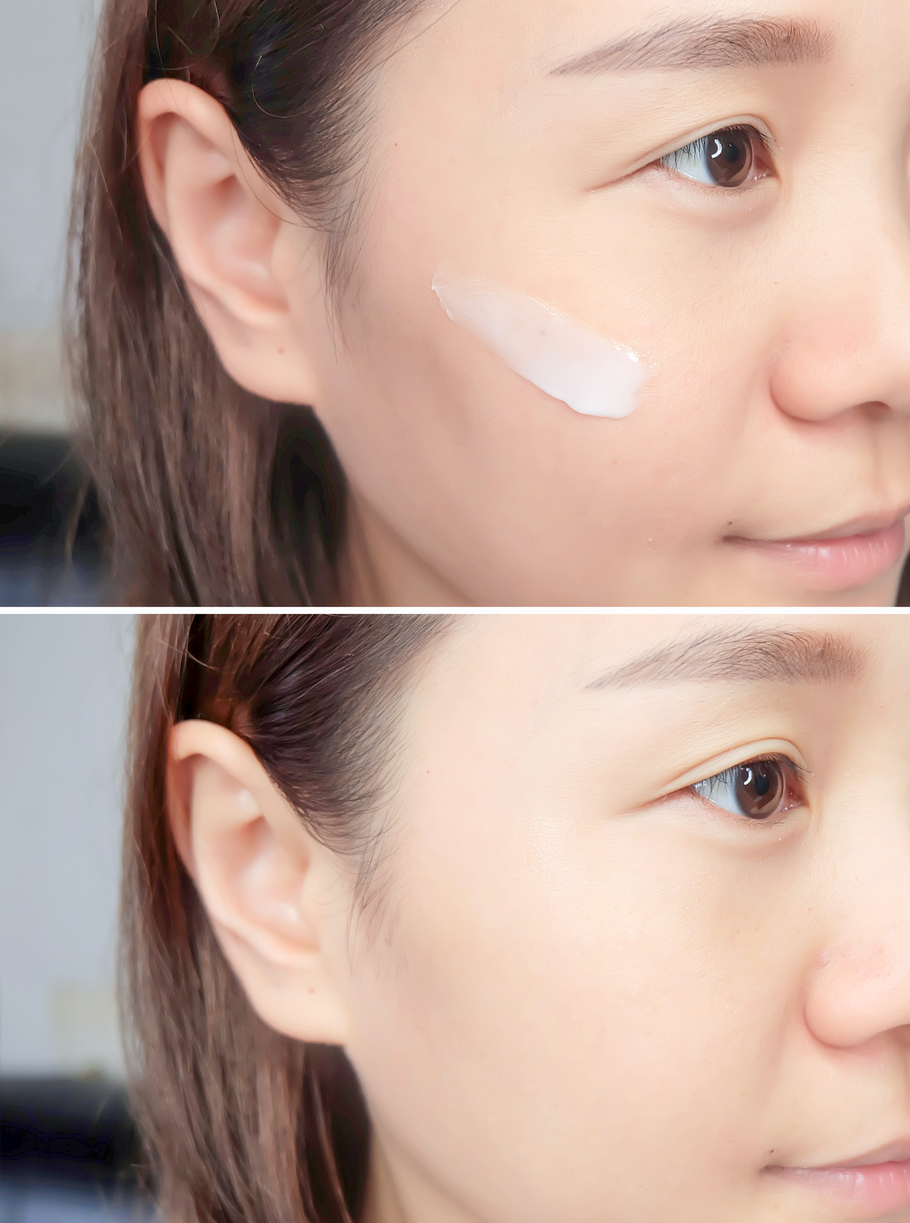 娲昏鍖栫榾鐨勪腑鎴愯嵂鍙互娣″寲鏂戠偣,娲昏鍖栫榾鍏婚鑽湁鍝簺