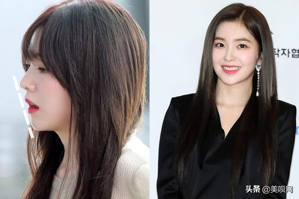 韩国整容模板jennie,韩国整形面容