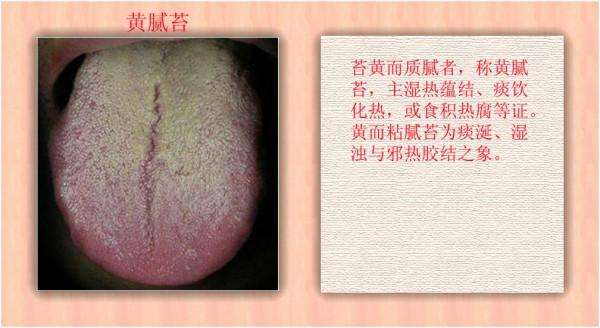 辨证论治的内容有什么,辨证论治看法