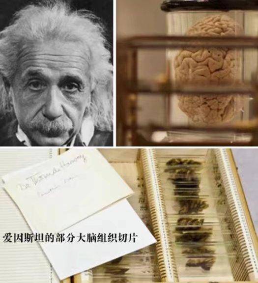 爱因斯坦大脑被偷背后的真相,爱因斯坦大脑被取出全过程