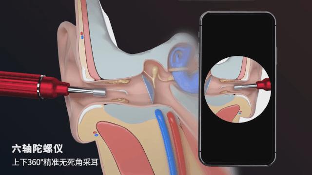 500万像素高清成像，隐秘耳道一览无遗，挖耳朵也能科技感爆棚