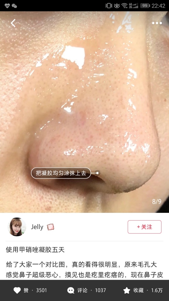 痘痘类型的黑头,痘痘黑头主要成分