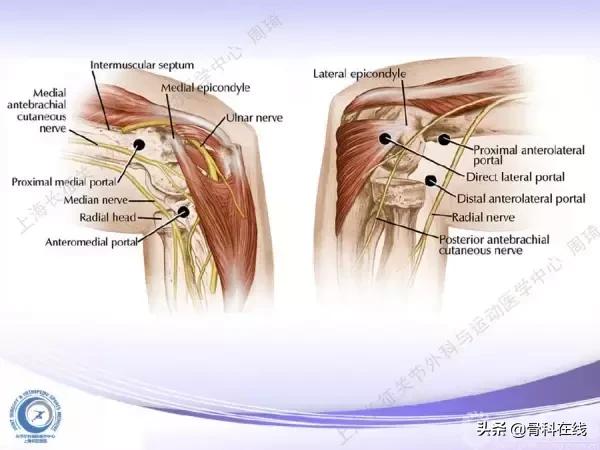 肘关节镜手术后引流,肘关节镜微创手术