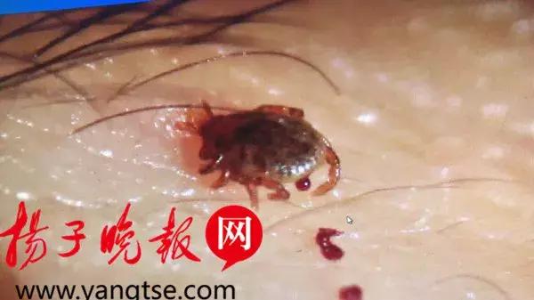 小小蜱虫危害大这些事项需注意,带宝宝外出怎么防草蜱虫