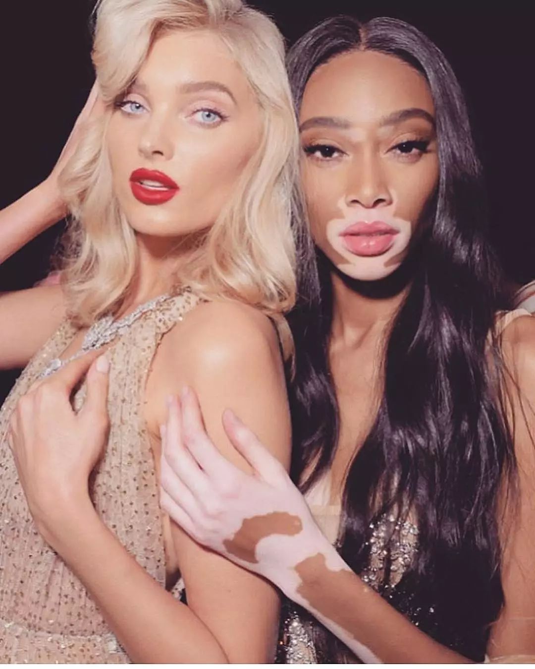 winnieharlow超模大赛,世界顶级超模winnieharlow
