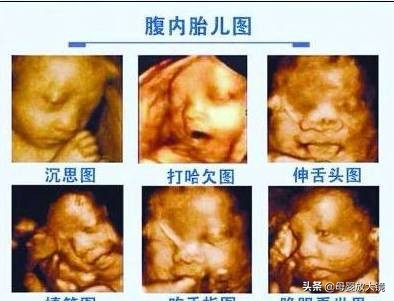 孕期产检:B超,唐筛,羊水穿刺,彩超...什么时间最合适?注意