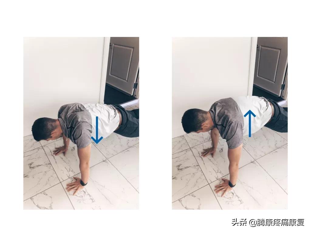 肩峰下撞击综合征的症状,肩峰下撞击综合征的机制是什么