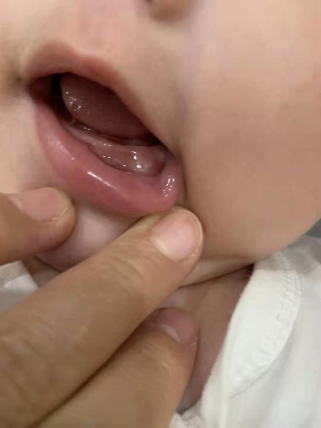 带宝宝经验视频,4-6个月宝宝出牙怎么办