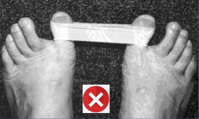 中老年女性拇外翻能矫正过来吗,女性脚拇指外翻原因