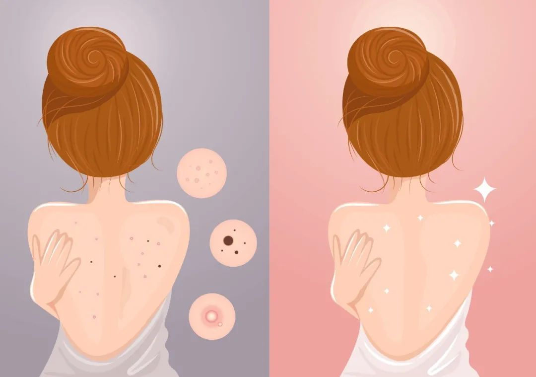 怎么连热巴、乔欣都变“油腻”了？女生夏天别栽在这5个细节上